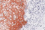 Procollagen IIA N-Peptide Antibody in Immunohistochemistry (Paraffin) (IHC (P))