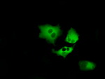 BTK Antibody in Immunocytochemistry (ICC/IF)