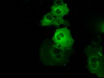 BTK Antibody in Immunocytochemistry (ICC/IF)