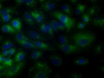 BTK Antibody in Immunocytochemistry (ICC/IF)