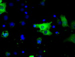 BTK Antibody in Immunocytochemistry (ICC/IF)