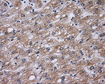 BTK Antibody in Immunohistochemistry (Paraffin) (IHC (P))