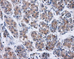 BTK Antibody in Immunohistochemistry (Paraffin) (IHC (P))