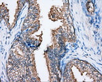 BTK Antibody in Immunohistochemistry (Paraffin) (IHC (P))