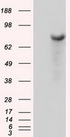 BTK Antibody in Western Blot (WB)