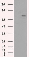 BTK Antibody in Western Blot (WB)