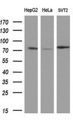 BTK Antibody in Western Blot (WB)