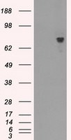 BTK Antibody in Western Blot (WB)