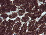 BTLA Antibody in Immunohistochemistry (Paraffin) (IHC (P))