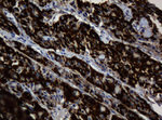 BTLA Antibody in Immunohistochemistry (Paraffin) (IHC (P))