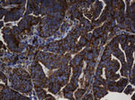 BTLA Antibody in Immunohistochemistry (Paraffin) (IHC (P))