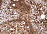 BTLA Antibody in Immunohistochemistry (Paraffin) (IHC (P))