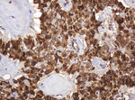 BTLA Antibody in Immunohistochemistry (Paraffin) (IHC (P))