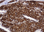 BTLA Antibody in Immunohistochemistry (Paraffin) (IHC (P))