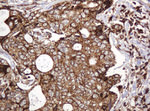 BTLA Antibody in Immunohistochemistry (Paraffin) (IHC (P))