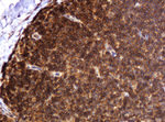 BTLA Antibody in Immunohistochemistry (Paraffin) (IHC (P))