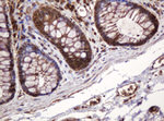 BTLA Antibody in Immunohistochemistry (Paraffin) (IHC (P))