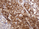 BTLA Antibody in Immunohistochemistry (Paraffin) (IHC (P))