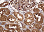 BTLA Antibody in Immunohistochemistry (Paraffin) (IHC (P))