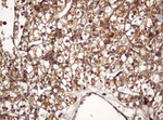 BTLA Antibody in Immunohistochemistry (Paraffin) (IHC (P))