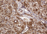 BTLA Antibody in Immunohistochemistry (Paraffin) (IHC (P))