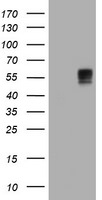 BTLA Antibody in Western Blot (WB)