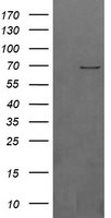 BTRC Antibody in Western Blot (WB)