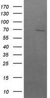 BTRC Antibody in Western Blot (WB)