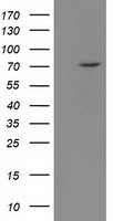 BTRC Antibody in Western Blot (WB)