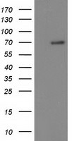 BTRC Antibody in Western Blot (WB)