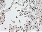 BUB1B Antibody in Immunohistochemistry (Paraffin) (IHC (P))