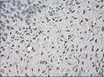 BUB1B Antibody in Immunohistochemistry (Paraffin) (IHC (P))