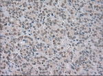 BUB1B Antibody in Immunohistochemistry (Paraffin) (IHC (P))