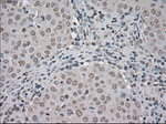 BUB1B Antibody in Immunohistochemistry (Paraffin) (IHC (P))