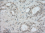 BUB1B Antibody in Immunohistochemistry (Paraffin) (IHC (P))