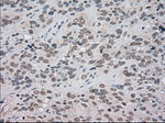 BUB1B Antibody in Immunohistochemistry (Paraffin) (IHC (P))