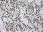 BUB1B Antibody in Immunohistochemistry (Paraffin) (IHC (P))