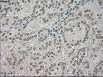 BUB1B Antibody in Immunohistochemistry (Paraffin) (IHC (P))