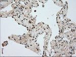 BUB1B Antibody in Immunohistochemistry (Paraffin) (IHC (P))