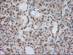 BUB1B Antibody in Immunohistochemistry (Paraffin) (IHC (P))