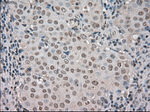 BUB1B Antibody in Immunohistochemistry (Paraffin) (IHC (P))