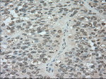 BUB1B Antibody in Immunohistochemistry (Paraffin) (IHC (P))