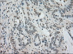 BUB1B Antibody in Immunohistochemistry (Paraffin) (IHC (P))