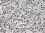 BUB1B Antibody in Immunohistochemistry (Paraffin) (IHC (P))