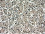 BUB1B Antibody in Immunohistochemistry (Paraffin) (IHC (P))