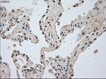 BUB1B Antibody in Immunohistochemistry (Paraffin) (IHC (P))