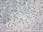 BUB1B Antibody in Immunohistochemistry (Paraffin) (IHC (P))