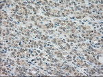 BUB1B Antibody in Immunohistochemistry (Paraffin) (IHC (P))