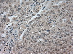 BUB1B Antibody in Immunohistochemistry (Paraffin) (IHC (P))