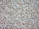 BUB1B Antibody in Immunohistochemistry (Paraffin) (IHC (P))